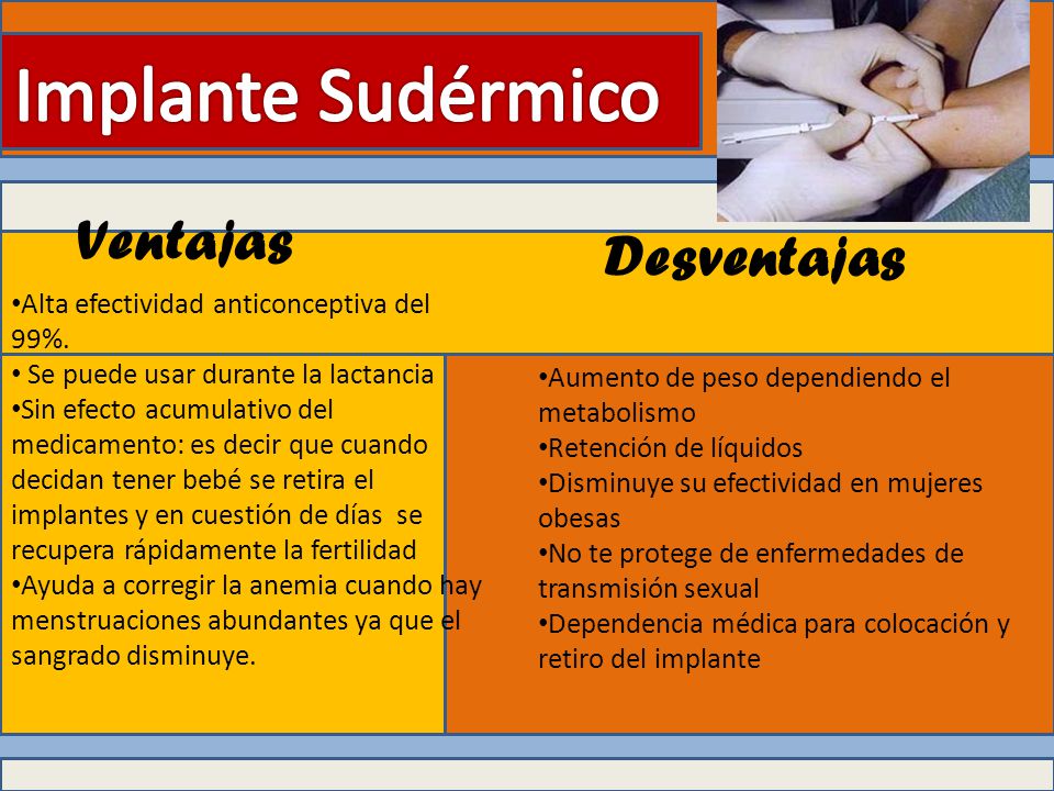 Metodo diu ventajas y desventajas